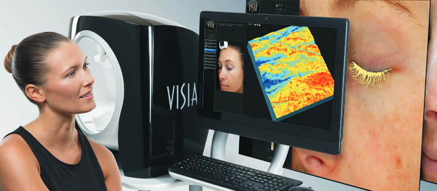 Visia® Skin Analysis Sarasota, FL