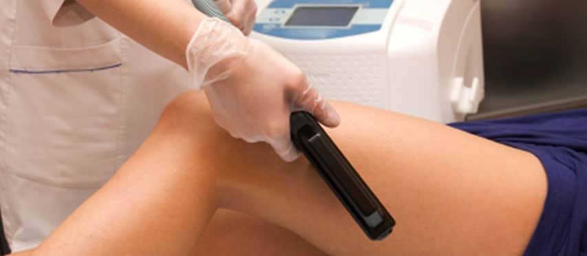 Laser Vein Treatment in Sarasota FL