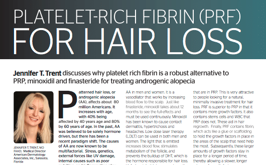 Hair Loss Treatment in Sarasota | Hair Regrowth with PRF