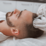 man getting hairloss injections treatment