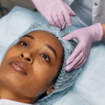 dermal fillers