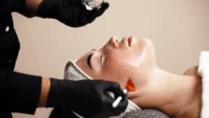 Provider applies a chemical peel to a patient’s face during treatment for sun-damaged skin.