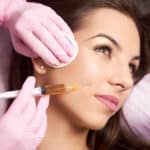 Brunette woman in her 30s receives a volumizing Restylane injection.